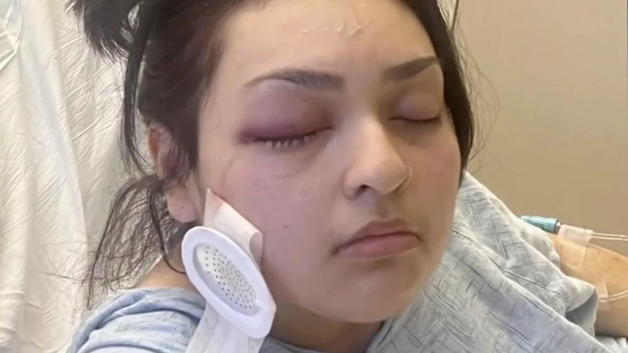 Good Samaritan, 19, loses eye while standing up for boy with special needs. Creep punched her twice in the head after she told him to stop bullying boy.